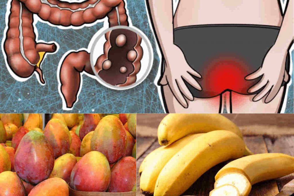 La consommation de la mangue et de la banane aide à prévenir et à combattre le cancer du côlon