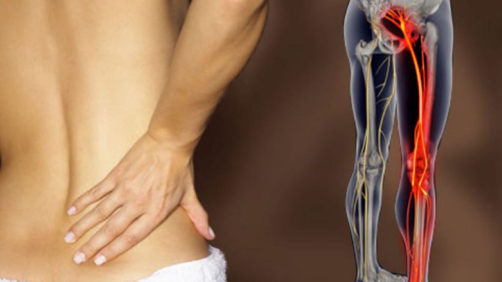 6 exercices pour soulager la douleur du nerf sciatique en quelques minutes