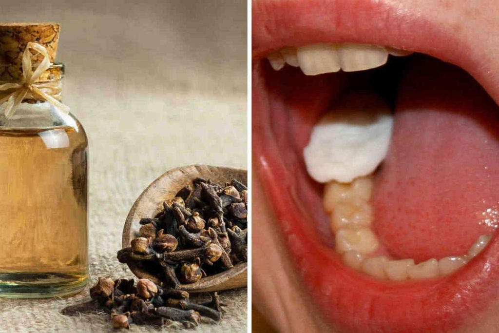 3 remèdes avec les clous de girofle pour se débarrasser du mal de dents