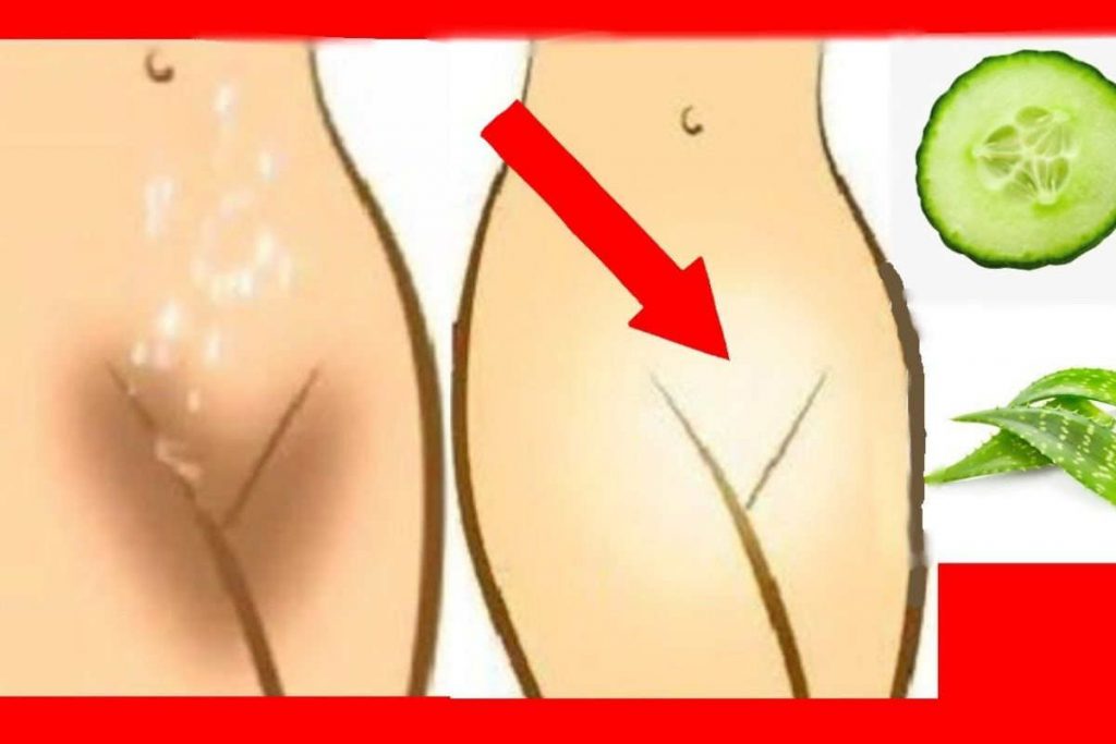 10 astuces naturelles pour blanchir les parties intimes naturellement à la maison