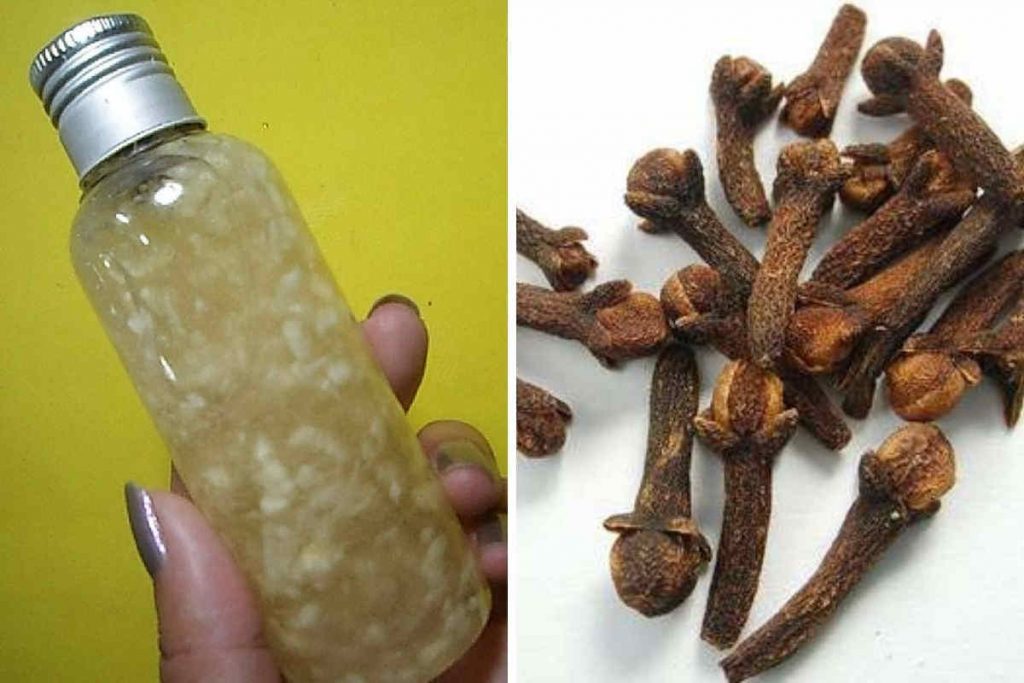 La recette du shampoing anti-pelliculaire aux clous de girofle et à l&rsquo;ail