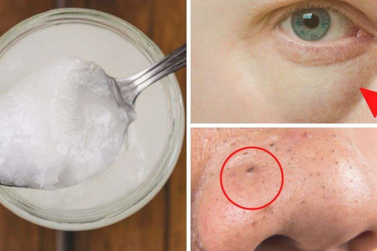 12 utilisations de l’huile de coco pour le visage que toutes les femmes doivent connaître