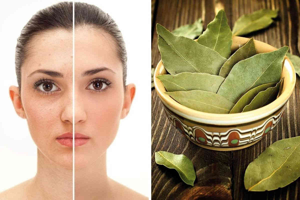 5 bienfaits surprenants des feuilles de laurier pour la beauté de la peau
