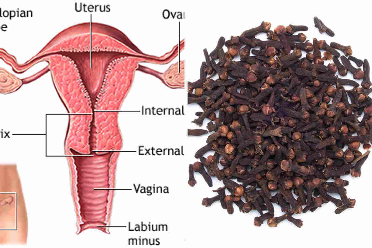 Voici comment utiliser le clou de girofle pour nettoyer l&rsquo;utérus